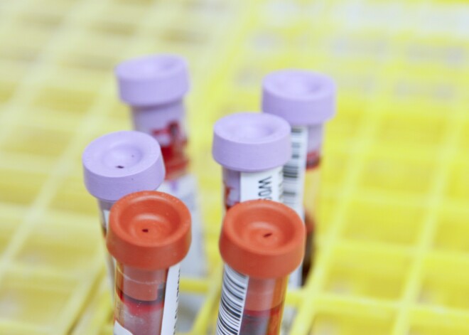 Pērn Latvijā bija 8221 HIV inficēts iedzīvotājs