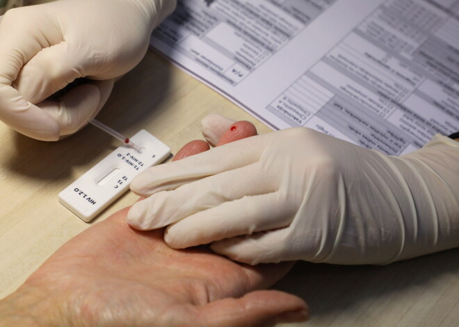 Pozitīva tendence - divu gadu laikā būtiski samazinājusies HIV, B un C hepatīta izplatība