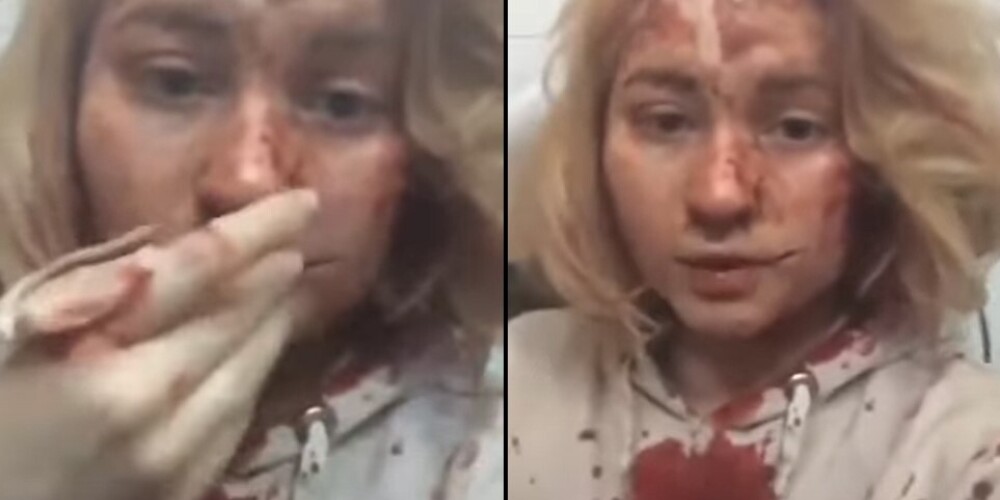 "В школе было много детей": выжившая после бомбежки Чернигова девушка-подросток записала видео