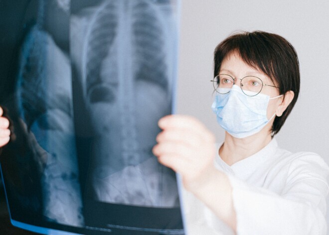 Tā nav tikai bezpajumtnieku slimība, inficēties var jebkurš! Kas ikvienam ir jāzina par tuberkulozi