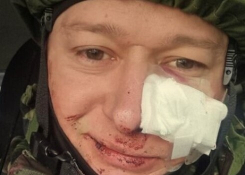 Лидер украинской группы "Бумбокс" попал под минометный обстрел