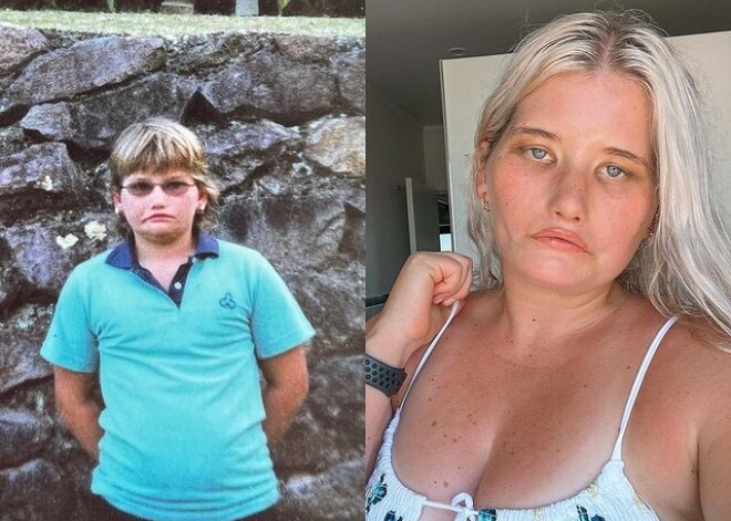 Девушка, которая ни разу в жизни не улыбалась, стала моделью, несмотря на редкую болезнь