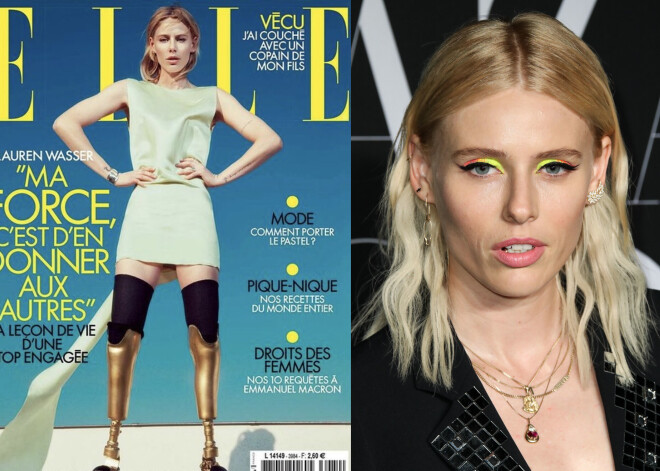 На обложке французского Elle - девушка с золотыми протезами