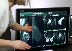 Kaut visam nepietiek, ieguldījumi onkoloģijā ir vērā ņemami, tostarp modernā diagnostikā. Rīgas Austrumu klīniskā universitātes slimnīca, piemēram, 2020. gadā iegādājās iekārtu, kas ļauj atklāt melanomu, krūts, kuņģa un citus vēža veidus. 