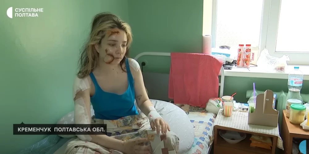 "Меня нашли под завалами": пострадавшая от ракетного удара в ТЦ Кременчуга думала, что это всего лишь сон