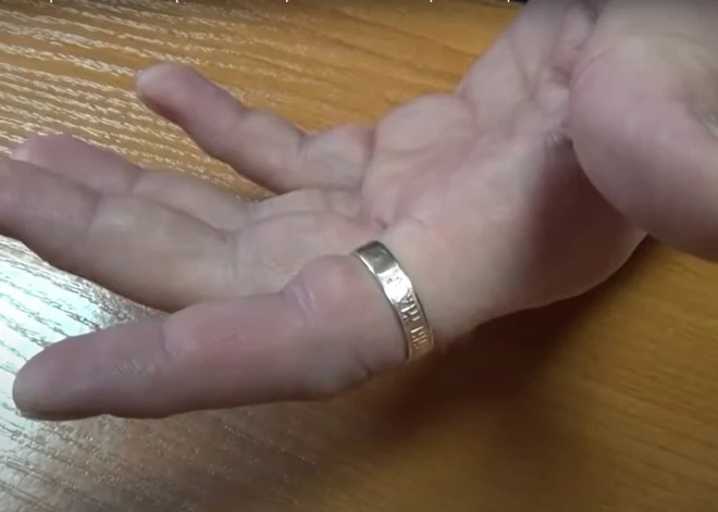 Как снять кольцо с опухшего пальца: 7 простых способов