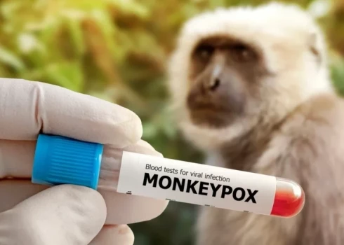 ВОЗ рекомендует проводить вакцинацию от оспы обезьян