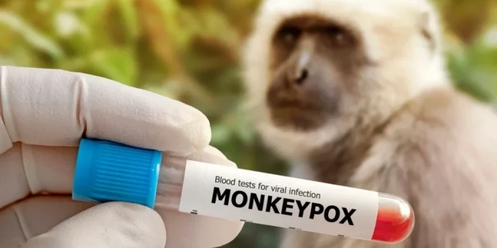 Вакцинацию от оспы обезьян не планируется проводить в обширных масштабах