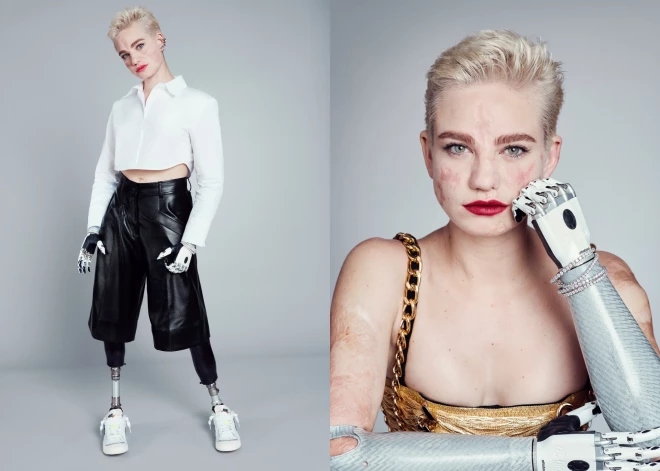 Новый амбассадор L'Oreal Paris — единственная в мире фехтовальщица с протезами рук и ног