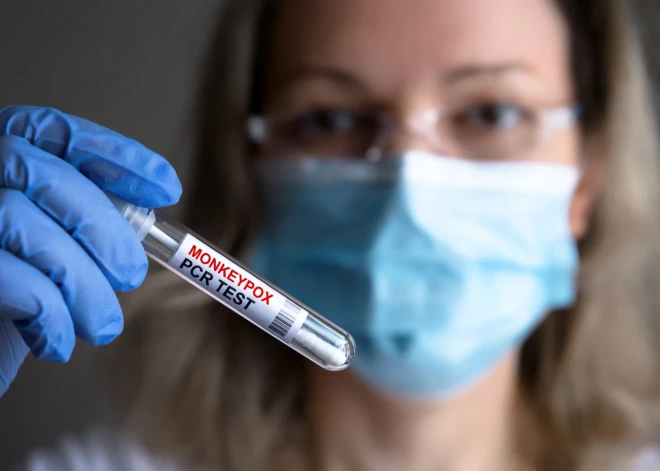 Lielbritānijā atklāts jauns pērtiķu baku celms, kas varētu būt 10 reizes nāvējošāks