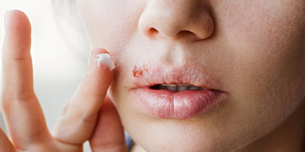 Иллюстративное фото