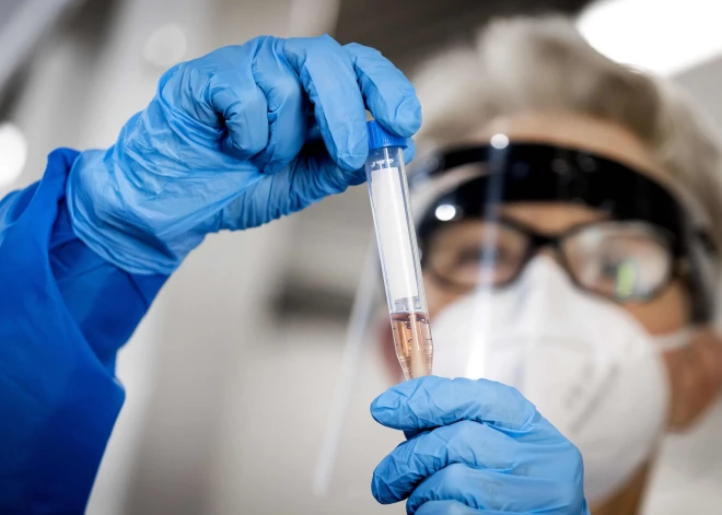 Ceturtdien Latvijā reģistrēts 921 jauns Covid-19 gadījums un ziņots par vienu mirušo