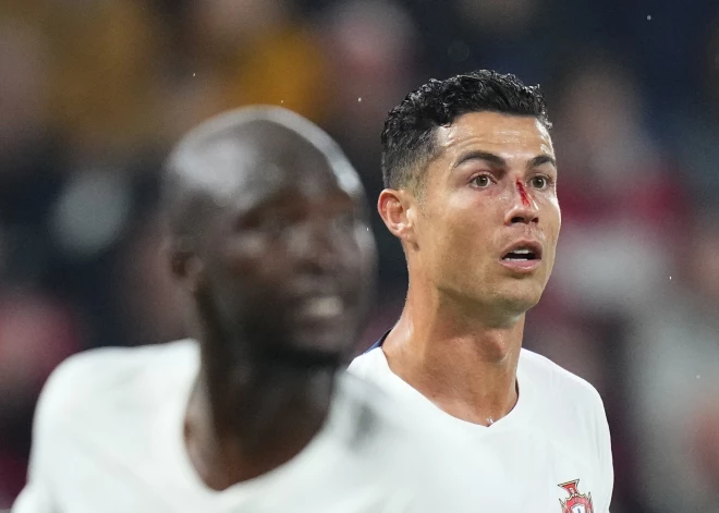 Ronaldu pārsistais deguns netraucē Portugālei sagraut Čehiju