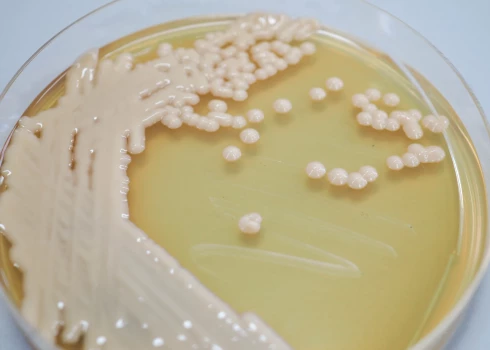 Cryptococcus neoformans