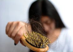8 mikroelementi, kuru trūkums var rezultēties matu izkrišanā