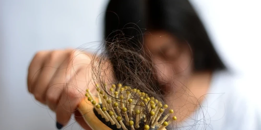 Причиной повышенного выпадения волос может стать как недостаток витаминов, так и наоборот - их передозировка.