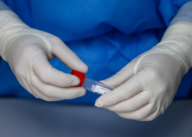 Latvijā reģistrēti 460 jauni Covid-19 inficēšanās gadījumi