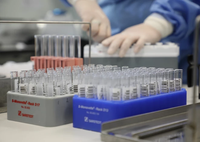 Теперь тестирование на Covid-19 в Латвии оплачивают только пациентам больниц