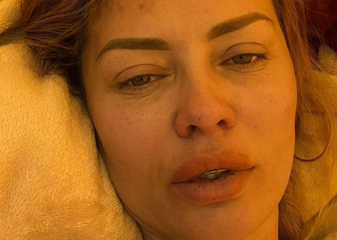 "Когда так хреново, то думаю: зачем поперлась в горы?": изможденная Виктория Боня показала себя без прикрас