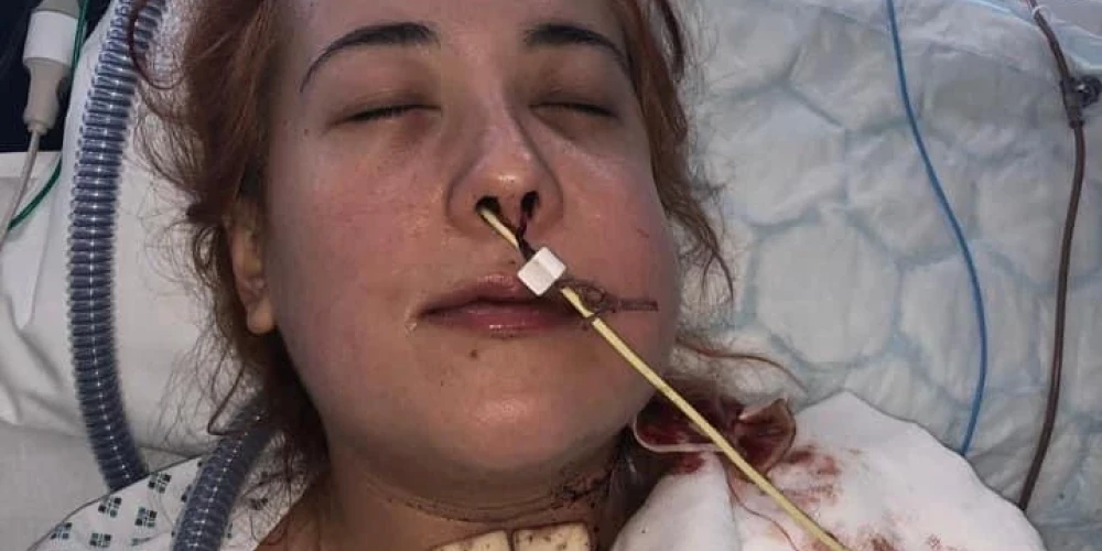 25 gadus vecā Džordana Del Nero no Šefīldas, Lielbritānijā.