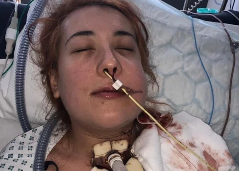 25 gadus vecā Džordana Del Nero no Šefīldas, Lielbritānijā.