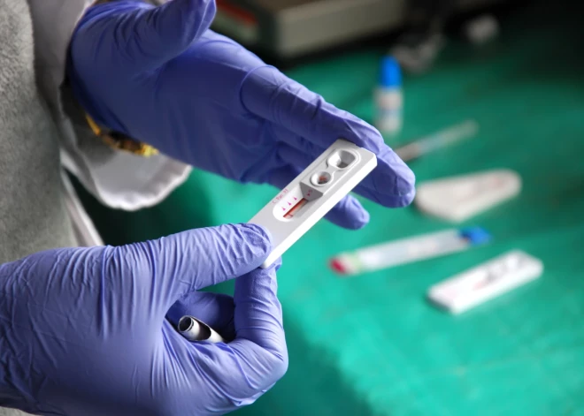 Ārstējot citu slimību, vīrietim no Vācijas izdodas pilnībā izveseļoties arī no HIV