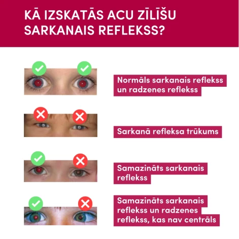 Sarkanā refleksa tests. 