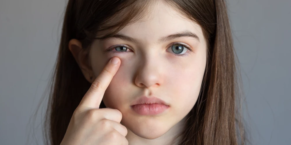 Bērnu slimnīcas acu ārsti vērš uzmanību uz divām retām acu slimībām, ko iespējams atklāt, veicot pavisam vienkāršu testu