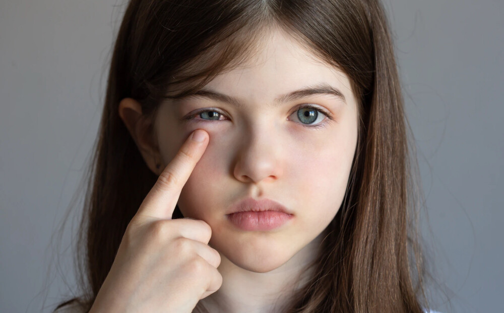 Bērnu slimnīcas acu ārsti vērš uzmanību uz divām retām acu slimībām, ko iespējams atklāt, veicot pavisam vienkāršu testu