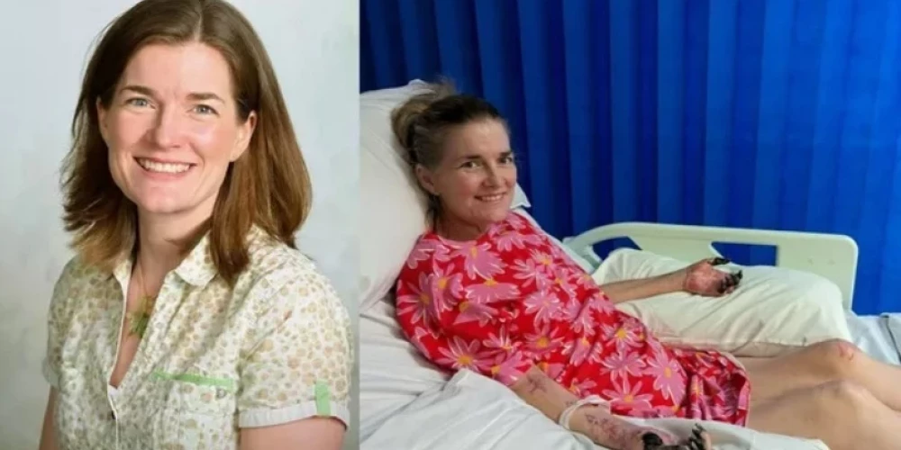 44 gadus veca britu skolotāja zaudē kājas pēc saslimšanas ar gripu