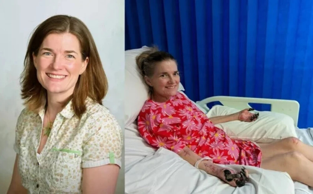 44 gadus veca britu skolotāja zaudē kājas pēc saslimšanas ar gripu