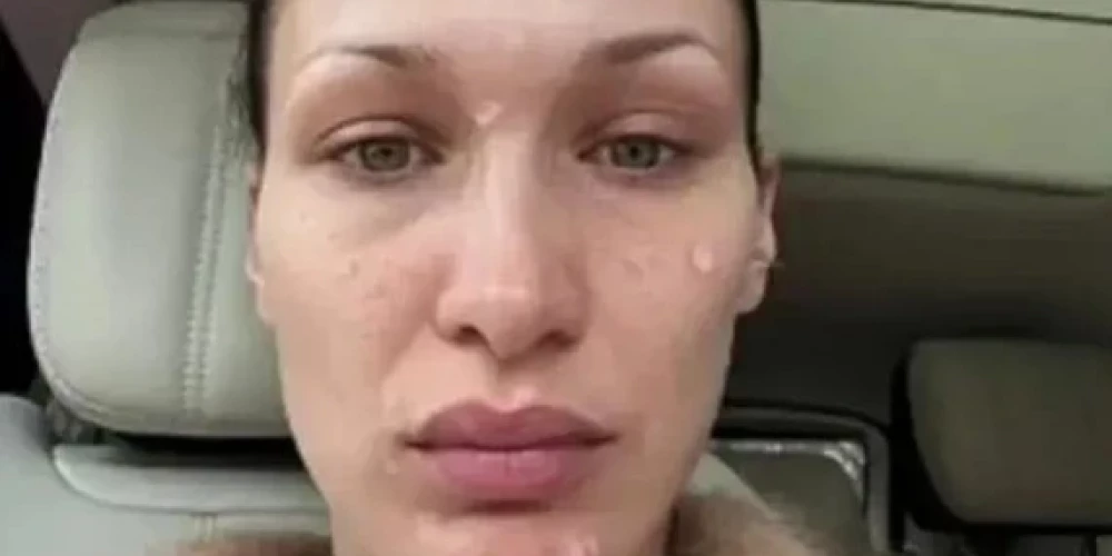 Белла Хадид показала, что происходит с ее лицом
