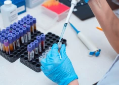 Ar vienkāršu “papīra testu” varētu noteikt vēzi agrīni, pieļauj pētnieki