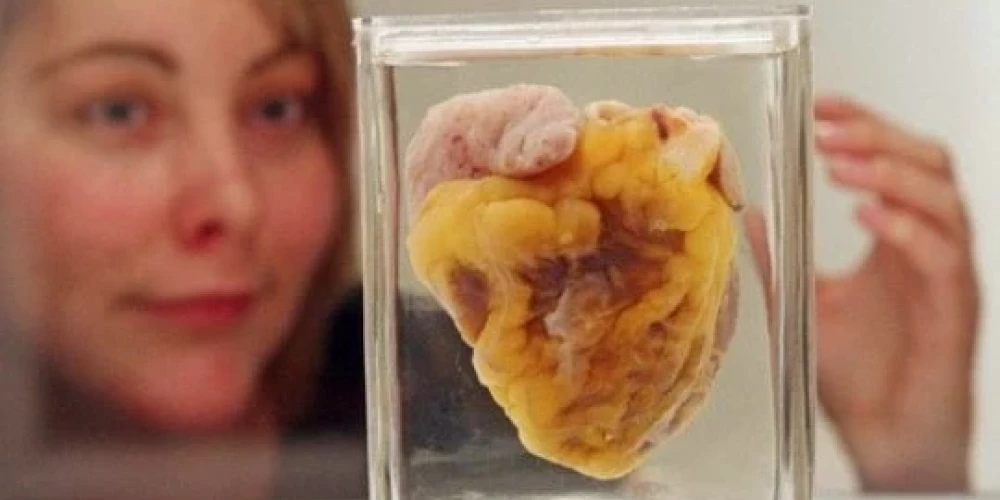 Sieviete Londonas muzejā apskata pašas sirdi