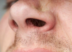 Иллюстративное фото