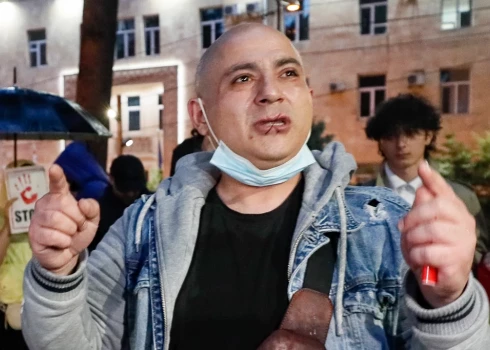 Зашил себе рот и глаз: в Тбилиси отец требует освободить сына, которого задержали на протестах