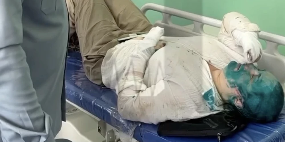 У Елены Милашиной сломано несколько пальцев рук, она несколько раз теряла сознание. (Фото: скриншот видео)