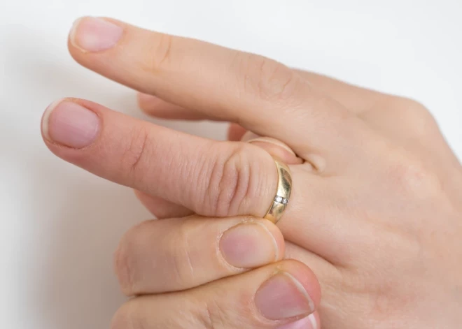 Лед, зубная нить и не только: способы, как снять кольцо с опухшего пальца