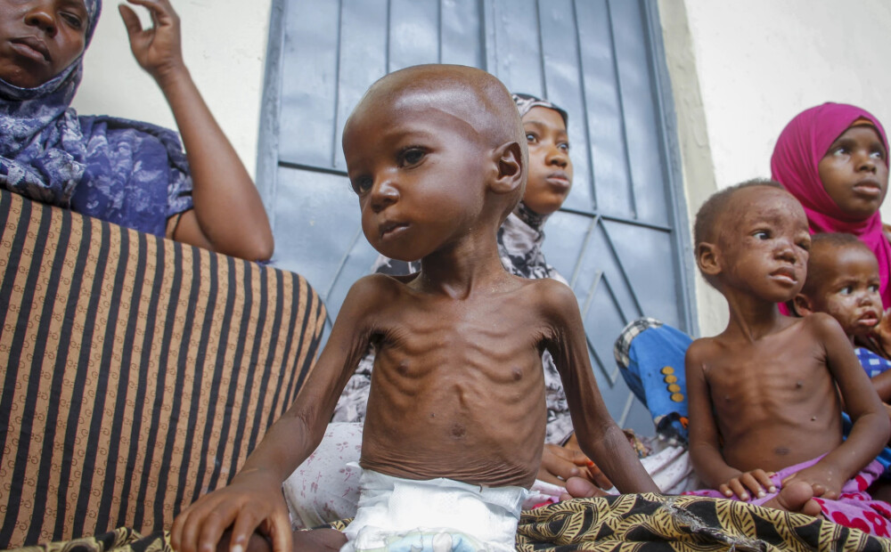 ANO: Pasaulē 735 miljoni cilvēku cieš no bada vai nepietiekama uztura
