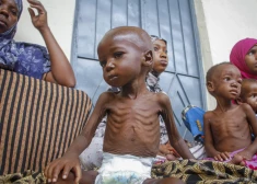 ANO: Pasaulē 735 miljoni cilvēku cieš no bada vai nepietiekama uztura