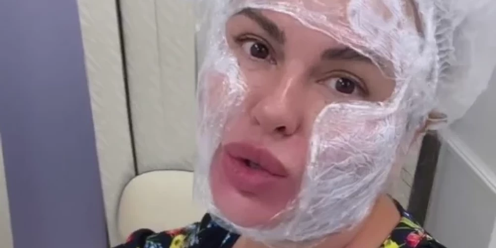Анна Семенович сделала болезненные уколы красоты, чтобы сузить лицо, и сравнила это с экзекуцией
