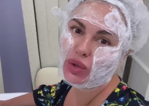 Анна Семенович сделала болезненные уколы красоты, чтобы сузить лицо, и сравнила это с экзекуцией