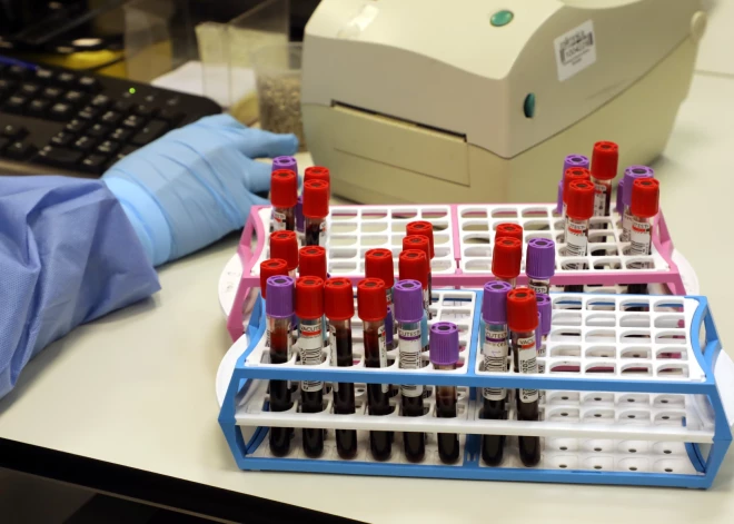 Квоты закончились, готовьтесь раскошелиться! Лаборатории предупреждают о платных услугах