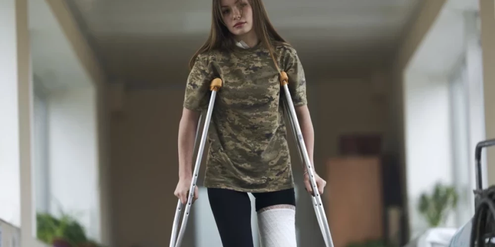 С начала войны 50 000 украинцев потеряли руки и ноги