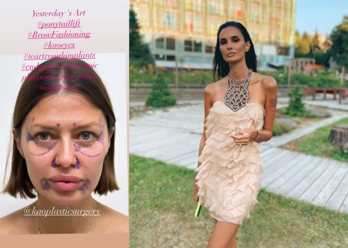 "Главное - до последнего врать": бывшая жена Мамаева высмеяла фото Бони до пластики лица