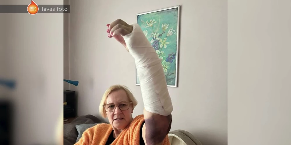 Пенсионерка сломала руку в автоматической двери т/ц Damme