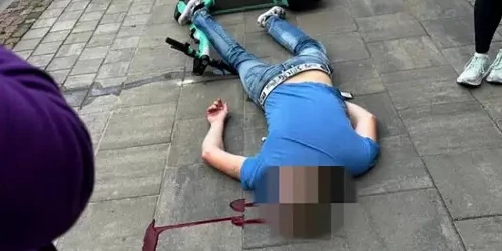 Лежал в луже крови: молодой человек в центре Риги упал с прокатного самоката