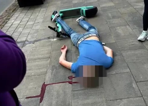 Лежал в луже крови: молодой человек в центре Риги упал с прокатного самоката