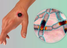 Иллюстративное фото