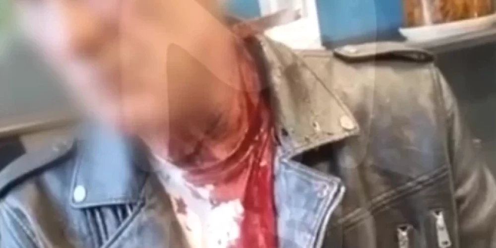 Всех удивил не только нож, торчащий из шеи, но и спокойствие потерпевшего.
